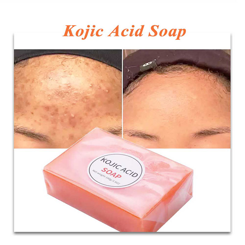 kojie san whitening soap