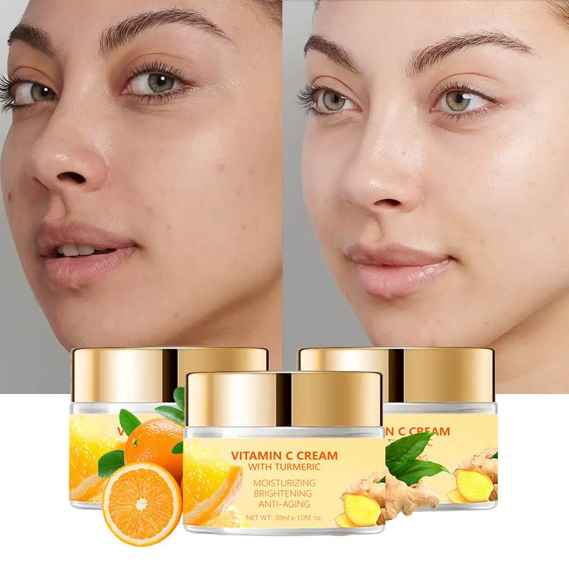 Dites adieu aux taches brunes avec une crème pour le visage à la vitamine C pour un éclat de jeunesse